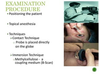 EXAMINATION
PROCEDURE
 Positioning the patient
 Topical anesthesia
 Techniques
Contact Technique
o Probe is placed directly
on the globe
Immersion Technique
oMethylcellulose - a
coupling medium (B-Scan)
 