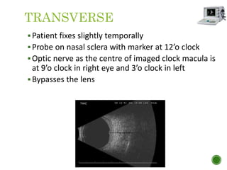 TRANSVERSE
Patient fixes slightly temporally
Probe on nasal sclera with marker at 12’o clock
Optic nerve as the centre of imaged clock macula is
at 9’o clock in right eye and 3’o clock in left
Bypasses the lens
 