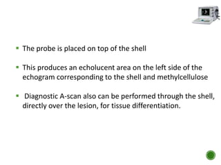  The probe is placed on top of the shell
 This produces an echolucent area on the left side of the
echogram corresponding to the shell and methylcellulose
 Diagnostic A-scan also can be performed through the shell,
directly over the lesion, for tissue differentiation.
 