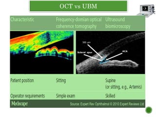 OCT vs UBM
 