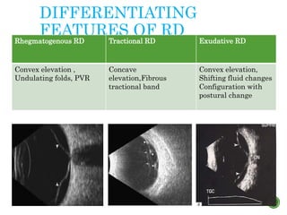 DIFFERENTIATING
FEATURES OF RD
Rhegmatogenous RD Tractional RD Exudative RD
Convex elevation ,
Undulating folds, PVR
Concave
elevation,Fibrous
tractional band
Convex elevation,
Shifting fluid changes
Configuration with
postural change
 