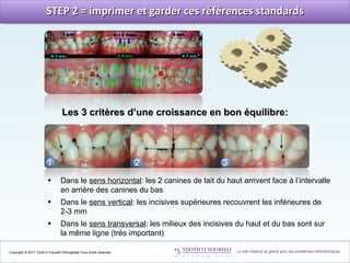Copyright © 2011 Tooth’It Yourself Orthoglobal.Tous droits réservés. STEP 2 = imprimer et garder ces références standards ...