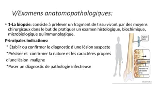 V/Examens anatomopathologiques:
• 1-La biopsie: consiste à prélever un fragment de tissu vivant par des moyens
chirurgicaux dans le but de pratiquer un examen histologique, biochimique,
microbiologique ou immunologique.
Principales indications:
* Établir ou confirmer le diagnostic d’une lésion suspecte
*Préciser et confirmer la nature et les caractères propres
d’une lésion maligne
*Poser un diagnostic de pathologie infectieuse
 