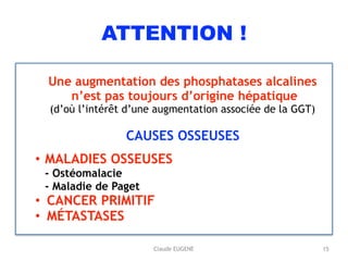 ATTENTION !
Une augmentation des phosphatases alcalines
n’est pas toujours d’origine hépatique
(d’où l’intérêt d’une augmentation associée de la GGT)
CAUSES OSSEUSES
• MALADIES OSSEUSES 
- Ostéomalacie 
- Maladie de Paget
• CANCER PRIMITIF
• MÉTASTASES
15Claude EUGENE
 