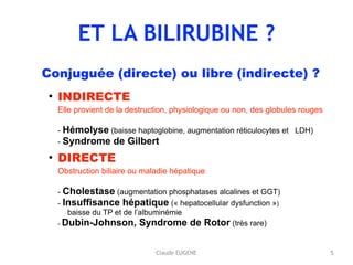 ET LA BILIRUBINE ?
Conjuguée (directe) ou libre (indirecte) ?
• INDIRECTE 
Elle provient de la destruction, physiologique ou non, des globules rouges 
 
- Hémolyse (baisse haptoglobine, augmentation réticulocytes et LDH) 
- Syndrome de Gilbert
• DIRECTE  
Obstruction biliaire ou maladie hépatique 
 
- Cholestase (augmentation phosphatases alcalines et GGT) 
- Insuffisance hépatique (« hepatocellular dysfunction ») 
baisse du TP et de l’albuminémie 
- Dubin-Johnson, Syndrome de Rotor (très rare) 
5Claude EUGENE
 