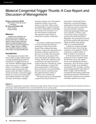 Bilateral Congenital Trigger Thumb: A Case Report and
Discussion of Management
Matthew J. Schessler, MS-III                  treatment options exist. The optimal           his thumbs. The thumb IP joint
     West Virginia University School          treatment window occurs from
       of Medicine
                                                                                             independent of his hand position.
W. Thomas McClellan, MD
                                              and splinting are usually indicated
     Plastic Surgeon
     Private Practice                         for infants and toddlers. If splinting         extend his IP joints while his

                                              the child remains symptomatic                  were extended. A Notta’s node
Abstract                                      after age three, then surgery to               was present, tender to palpation,
     Trigger thumb, although rare,            release the A1 pulley is indicated.
is the most common stenosing
tenosynovitis seen in children. We            Case
report a case of a late presenting
bilateral congenital trigger thumb
and a review of current management            4½-year-old male with bilateral
options. Trigger thumb in children            contracture of the IP joint of the                A diagnosis of bilateral trigger
is an important condition to identify         thumb. This condition had been
early, triage, and appropriately treat.       present as long as his step-mother can
                                                                                             contracture, surgical release of
Introduction                                  the prior six months. She noted that           both A1 pulleys was indicated.
                                              the contracture caused pain at the
                                              base of his thumb and fatigue when
                                              writing. The IP joint contracture also         the MP joint crease. The digital
contracture, or trigger thumb, is a           caused him to be upset because he


                                              past medical history, birth history,           and isolated. The A1 pulley was then
thumb usually present after the               and social history are unremarkable;
parents notice the child’s inability to                                                      blade. Finally, with the MP joint
extend his thumbs. Untreated trigger          the patient had been unable to                 extended IP joint testing yielded full,
thumb can cause serious functional                                                           unhindered extension of the IP joint.
                                                 The hand exam was unremarkable              The patient’s thumbs were protected



Figure 1.
Preoperative photographs of a patient with bilateral trigger thumb. Note the IP joint contracture of both thumbs with full extension in




30      West Virginia Medical Journal
 