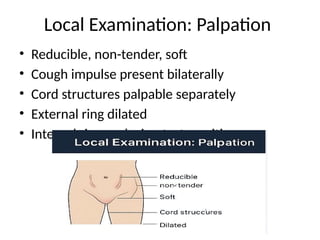 Bilateral_Inguinal_Hernia_Case_Presentation_with_Images.pptx
