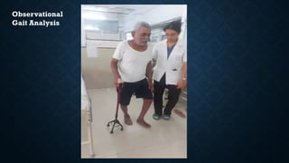 Observational
Gait Analysis
 