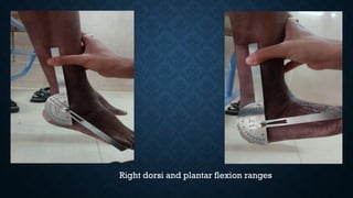 Right dorsi and plantar flexion ranges
 