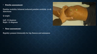 • Patella assessment:
Patellar mobility: bilateral reduced patellar mobility in all
directions
Q angle:
Left: 12 degrees
Right: 12 degrees
• Tone assessment:
Rigidity: present bilaterally for hip flexors and extensors
 