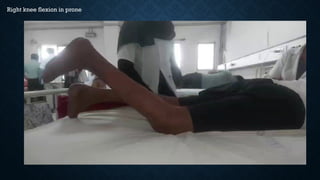 Right knee flexion in prone
 