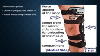 Orthotic Management
• Unloader (valgus) knee braces to
• reduce medial compartment load
 