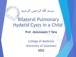 ‫الرحيم‬ ‫الرحمن‬ ‫هللا‬ ‫بسم‬
Bilateral Pulmonary
Hydatid Cysts in a Child
Prof. Abdulsalam Y Taha
College of Medicine
University of Sulaimani
2022 1
 