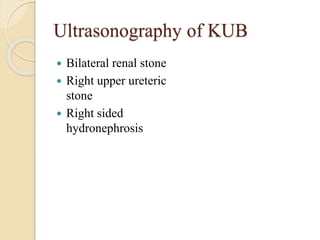 Ultrasonography of KUB
 Bilateral renal stone
 Right upper ureteric
stone
 Right sided
hydronephrosis
 