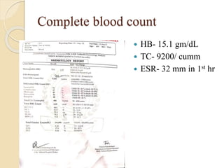 Complete blood count
 HB- 15.1 gm/dL
 TC- 9200/ cumm
 ESR- 32 mm in 1st hr
 