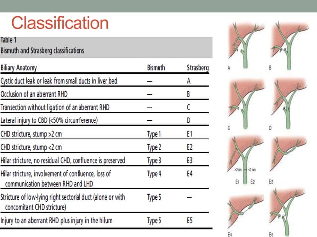 Bile duct injuries BDI | PPTX