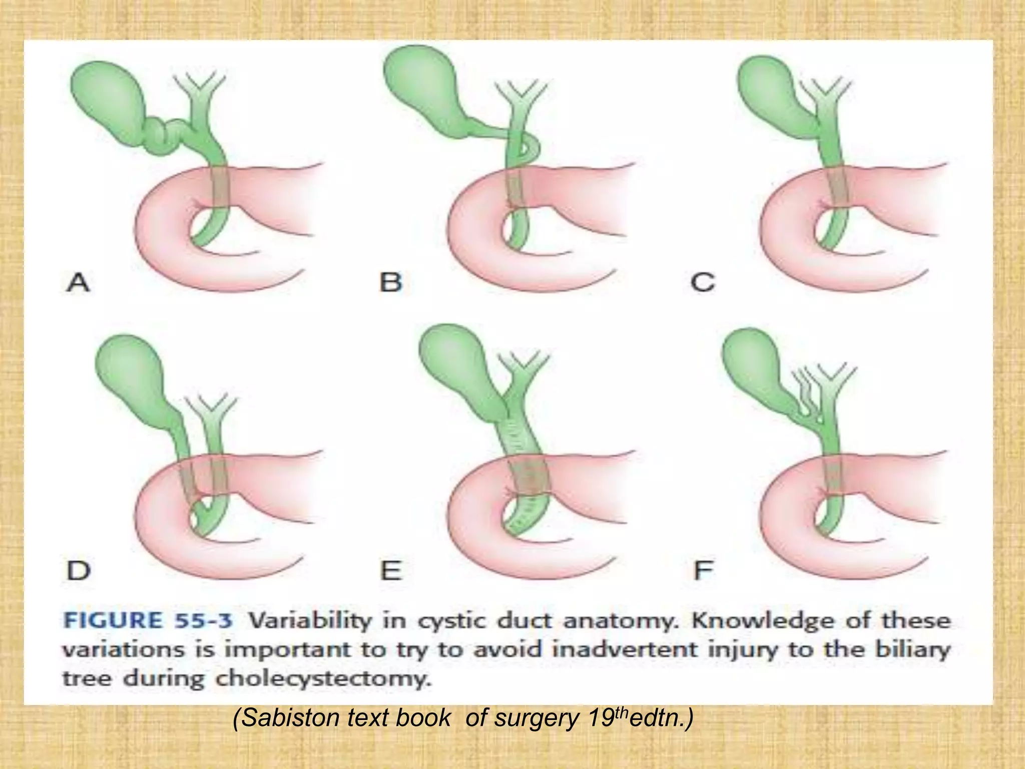 (Sabiston text book of surgery 19thedtn.)

 