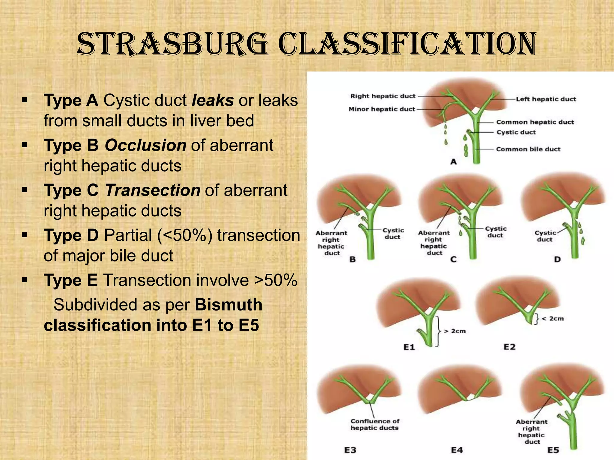 Strasburg Classification
 Type A Cystic duct leaks or leaks
from small ducts in liver bed
 Type B Occlusion of aberrant
right hepatic ducts
 Type C Transection of aberrant
right hepatic ducts
 Type D Partial (<50%) transection
of major bile duct
 Type E Transection involve >50%
Subdivided as per Bismuth
classification into E1 to E5

 
