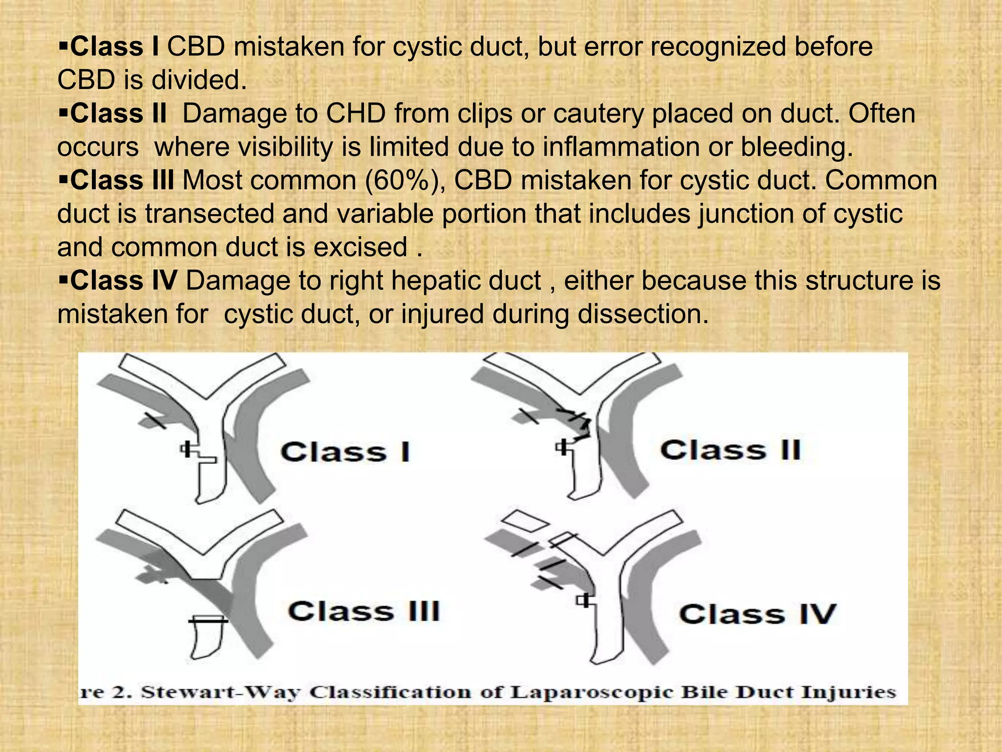 Class I CBD mistaken for cystic duct, but error recognized before
CBD is divided.
Class II Damage to CHD from clips or cautery placed on duct. Often
occurs where visibility is limited due to inflammation or bleeding.
Class III Most common (60%), CBD mistaken for cystic duct. Common
duct is transected and variable portion that includes junction of cystic
and common duct is excised .
Class IV Damage to right hepatic duct , either because this structure is
mistaken for cystic duct, or injured during dissection.

 