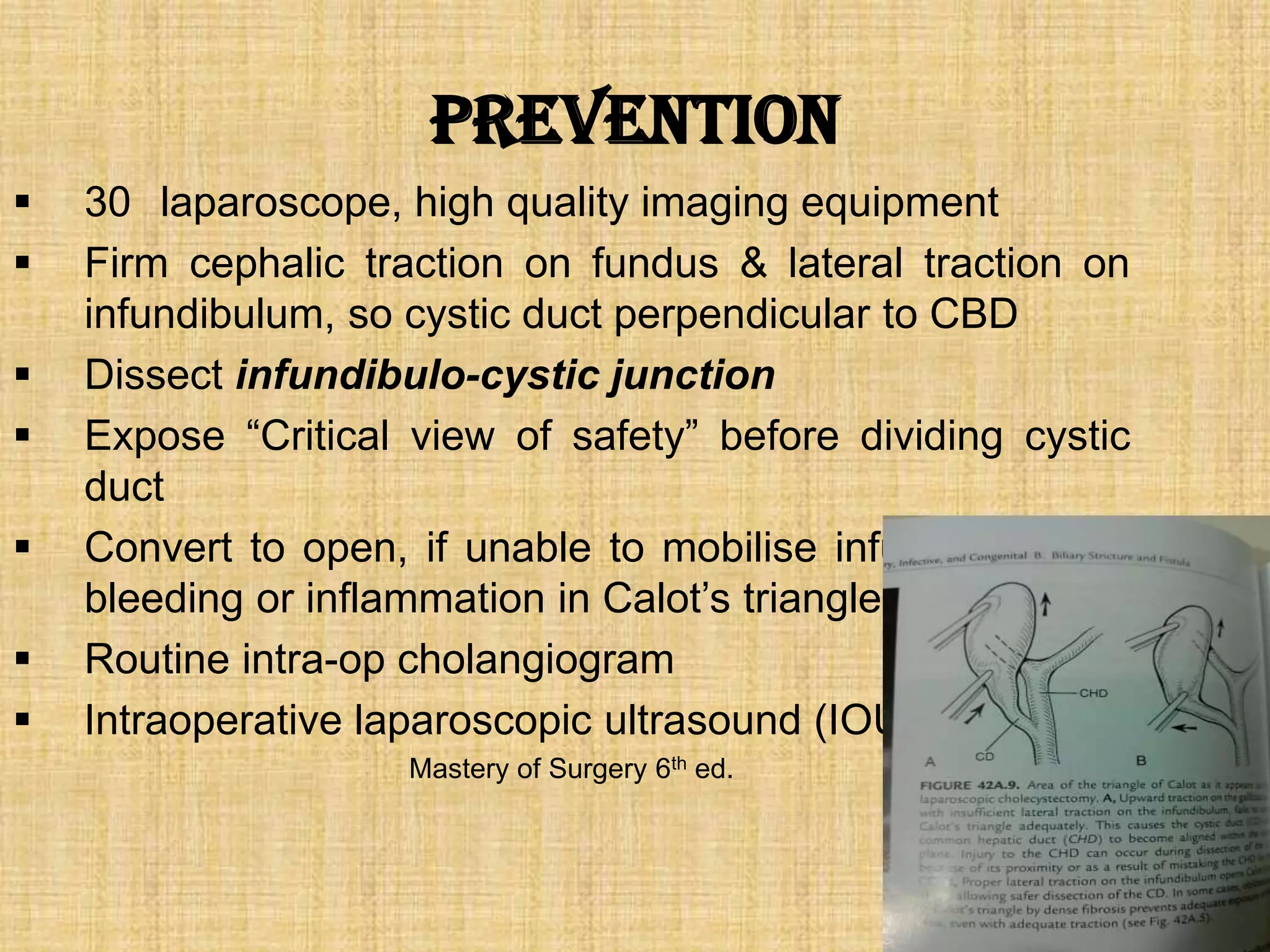 Prevention








30 laparoscope, high quality imaging equipment
Firm cephalic traction on fundus & lateral traction on
infundibulum, so cystic duct perpendicular to CBD
Dissect infundibulo-cystic junction
Expose “Critical view of safety” before dividing cystic
duct
Convert to open, if unable to mobilise infundibulum or
bleeding or inflammation in Calot‟s triangle
Routine intra-op cholangiogram
Intraoperative laparoscopic ultrasound (IOUS) .
Mastery of Surgery 6th ed.

 