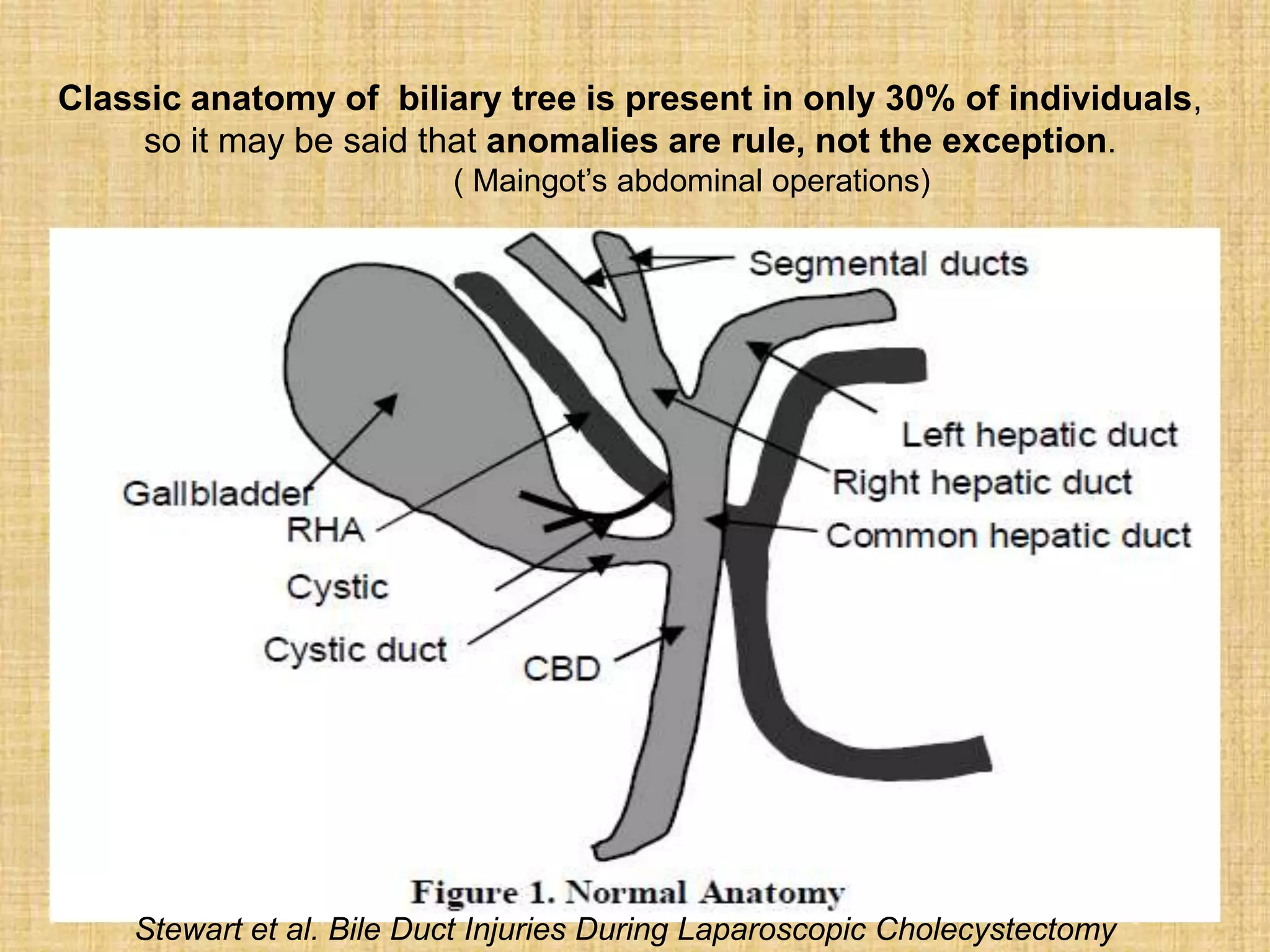 Classic anatomy of biliary tree is present in only 30% of individuals,
so it may be said that anomalies are rule, not the exception.
( Maingot‟s abdominal operations)

Stewart et al. Bile Duct Injuries During Laparoscopic Cholecystectomy

 