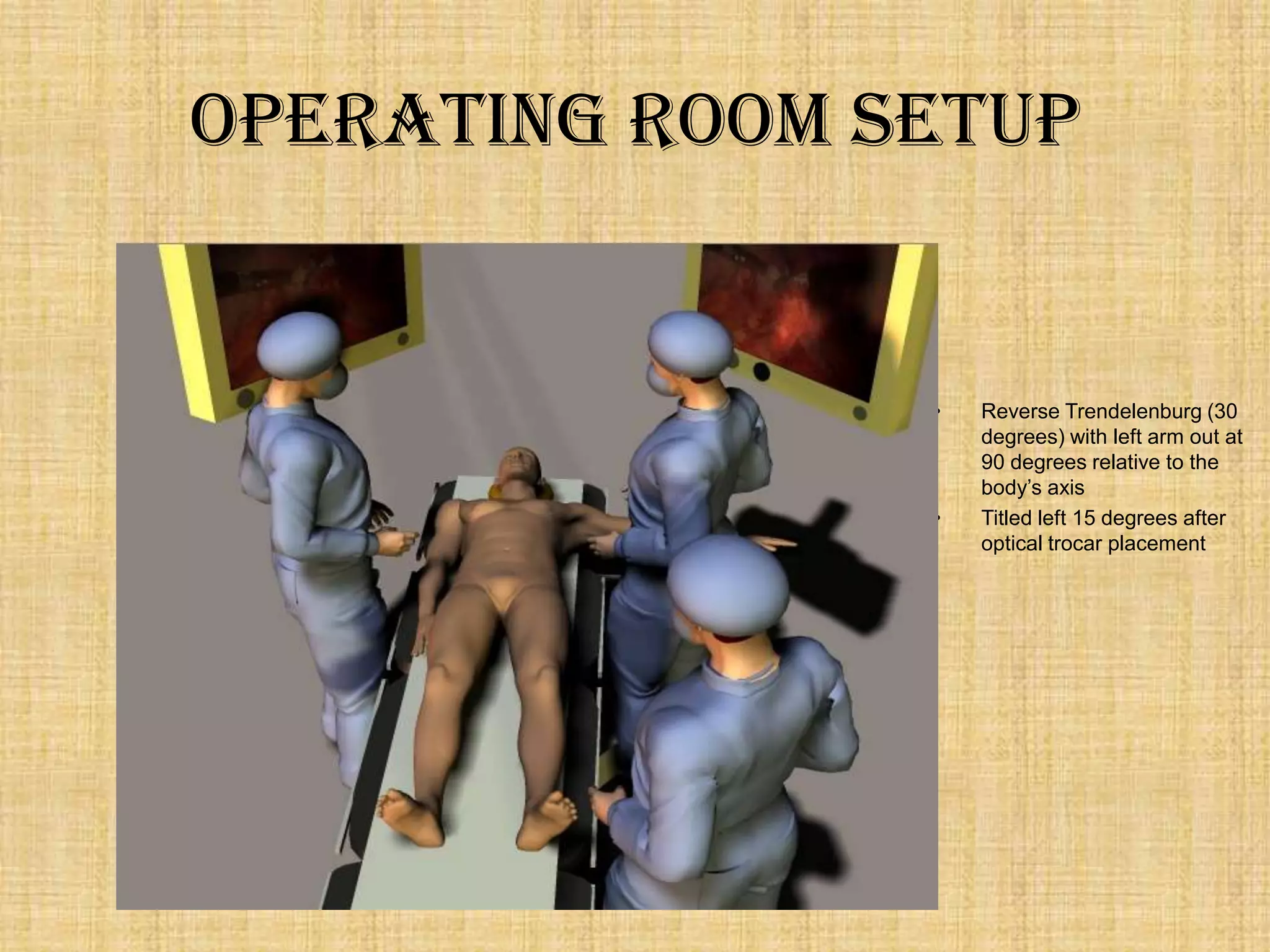 Operating Room Setup

•

•

Reverse Trendelenburg (30
degrees) with left arm out at
90 degrees relative to the
body‟s axis
Titled left 15 degrees after
optical trocar placement

 