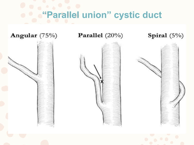 Bile duct injury | PPTX