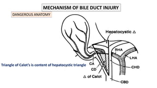 BILE DUCT INJURY_1.pptx