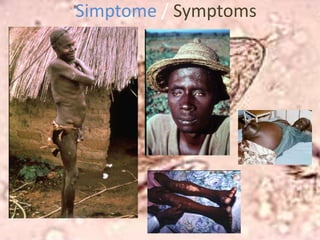 Eggs from faeces or urine in waterFase 2 / Phase 2Eiers broei uit in water vorm miracidia