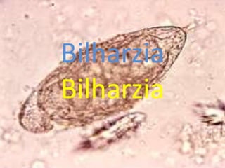 BilharziaBilharzia 
