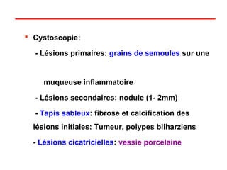  Cystoscopie:

  - Lésions primaires: grains de semoules sur une


     muqueuse inflammatoire

  - Lésions secondaires: nodule (1- 2mm)

  - Tapis sableux: fibrose et calcification des
  lésions initiales: Tumeur, polypes bilharziens

  - Lésions cicatricielles: vessie porcelaine
 