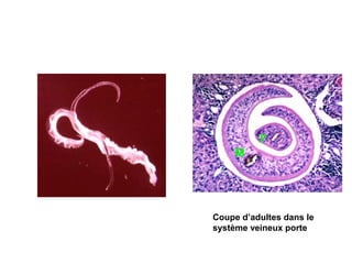 F
     M




Coupe d’adultes dans le
système veineux porte
 