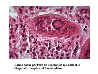 Coupe passe par l’axe de l’éperon ce qui permet le
diagnostic d’espèce: S.haematobium
 
