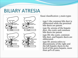 BILIARY ATRESIA
Kasai classification: 3 main types
- type I: the common bile duct is
obliterated while the proximal
bile ducts are patent.
- type IIa: atresia of the hepatic
duct, the cystic and common
bile ducts are patent
- type IIb: the cystic, common
bile duct, and hepatic ducts are
obliterated.
- type III: atresia refers to
discontinuity of the right and
the left hepatic ducts to the
level of the porta hepatis, more
than 90% of cases.
 