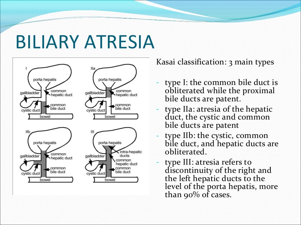 Atresia Bilier Patofisiologi Diagnosis Penatalaksanaa Vrogue co atresia-bilier-patofisiologi-diagnosis-penatalaksanaa-vrogue-co