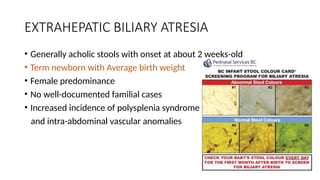 Biliary atresia critical case in pediatrics scenario.pptx