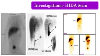 Investigations- HIDA Scan
 