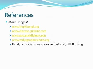 ReferencesMore images!www.hopkins-gi.orgwww.disease-picture.comwww.s00.middlebury.eduwww.radiographics.rsna.orgFinal picture is by my adorable husband, Bill Bunting
