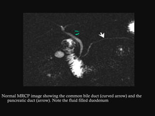 Biliary II _ Pancreas Biliary II _ Pancreas anatomy of radiologystudy ...