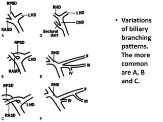 • Variations 
of biliary 
branching 
patterns. 
The more 
common 
are A, B 
and C. 
 