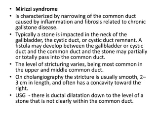 • Mirizzi syndrome 
• is characterized by narrowing of the common duct 
caused by inflammation and fibrosis related to chronic 
gallstone disease. 
• Typically a stone is impacted in the neck of the 
gallbladder, the cystic duct, or cystic duct remnant. A 
fistula may develop between the gallbladder or cystic 
duct and the common duct and the stone may partially 
or totally pass into the common duct. 
• The level of stricturing varies, being most common in 
the upper and middle common duct. 
• On cholangiography the stricture is usually smooth, 2– 
3 cm in length, and often has a concavity toward the 
right. 
• USG - there is ductal dilatation down to the level of a 
stone that is not clearly within the common duct. 
 
