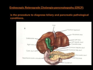 Biliary tract | PPSX