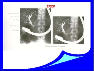 Biliary tract | PPSX