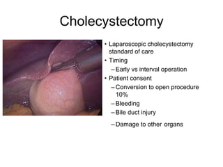 Cholecystectomy
• Laparoscopic cholecystectomy
standard of care
• Timing
– Early vs interval operation
• Patient consent
– Conversion to open procedure
10%
– Bleeding
– Bile duct injury
– Damage to other organs
 