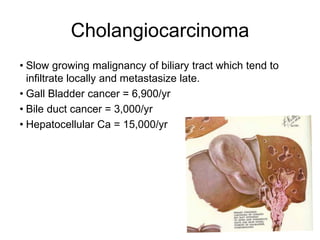 Cholangiocarcinoma
• Slow growing malignancy of biliary tract which tend to
infiltrate locally and metastasize late.
• Gall Bladder cancer = 6,900/yr
• Bile duct cancer = 3,000/yr
• Hepatocellular Ca = 15,000/yr
 