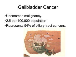 Gallbladder Cancer
•Uncommon malignancy
•2.5 per 100,000 population
•Represents 54% of biliary tract cancers.
 