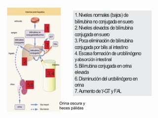 Orina oscura y heces pálidas 