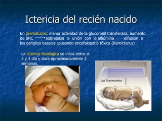 Ictericia del recién nacido En  prematuros : menor actividad de la glucoronil transferasa, aumento de BNC  sobrepasa  la  unión  con  la albúmina  difusión  a los ganglios basales causando encefalopatía tóxica (Kernicterus) La  ictericia fisiológica  se inicia entre el 2 y 3 día y dura aproximadamente 2 semanas. 
