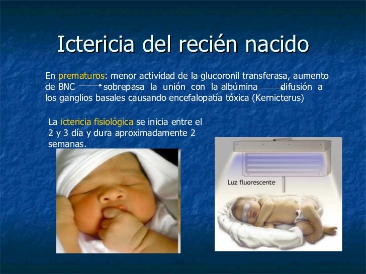 bilirrubina en recien nacido