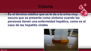 Coluria
• Es el término médico que se le da a la orina muy
oscura que se presenta como síntoma cuando las
personas tienen una enfermedad hepática, como es el
caso de las hepatitis virales
 